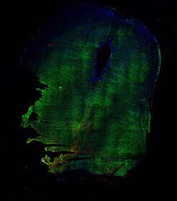 13PCW human midbrain